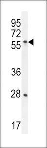 DLK1 / Pref-1 Antibody - DLK Antibody western blot of CEM cell line lysates (35 ug/lane). The DLK antibody detected the DLK protein (arrow).