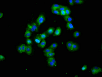 DLK1 / Pref-1 Antibody