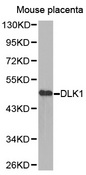 DLK1 / Pref-1 Antibody - Western blot analysis of extracts of mouse placenta tissue, using DLK1 antibody.