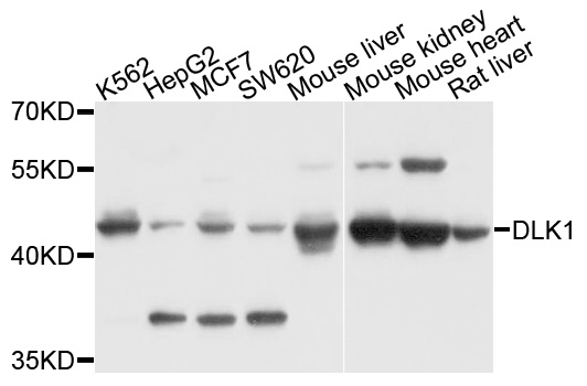 DLK1 / Pref-1 Antibody - Western blot analysis of extracts of various cells.
