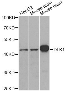DLK1 / Pref-1 Antibody - Western blot analysis of extracts of various cell lines, using DLK1 antibody at 1:1000 dilution. The secondary antibody used was an HRP Goat Anti-Rabbit IgG (H+L) at 1:10000 dilution. Lysates were loaded 25ug per lane and 3% nonfat dry milk in TBST was used for blocking. An ECL Kit was used for detection and the exposure time was 1s.