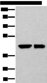 DLK1 / Pref-1 Antibody - Western blot analysis of HEPG2 and 231 cell lysates  using DLK1 Polyclonal Antibody at dilution of 1:250
