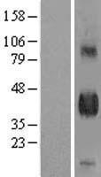 DLK1 / Pref-1 Protein - Western validation with an anti-DDK antibody * L: Control HEK293 lysate R: Over-expression lysate