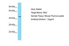 DLK2 Antibody -  This image was taken for the unconjugated form of this product. Other forms have not been tested.