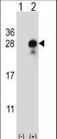 DLK2 Antibody - Western blot of DLK2 (arrow) using rabbit polyclonal DLK2 Antibody. 293 cell lysates (2 ug/lane) either nontransfected (Lane 1) or transiently transfected (Lane 2) with the DLK2 gene.