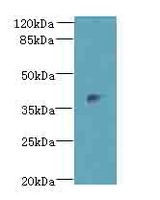 DLK2 Antibody - Western blot. All lanes: Dlk2 antibody at 5 ug/ml+Mos- kidney tissue Goat polyclonal to rabbit at 1:10000 dilution. Predicted band size: 40 kDa. Observed band size: 40 kDa.