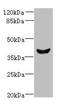 DLK2 Antibody - Western blot All lanes: Dlk2 antibody at 5µg/ml + Mouse kidney tissue Secondary Goat polyclonal to rabbit IgG at 1/10000 dilution Predicted band size: 41, 46, 45 kDa Observed band size: 41 kDa