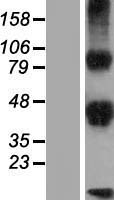 DLK2 Protein - Western validation with an anti-DDK antibody * L: Control HEK293 lysate R: Over-expression lysate