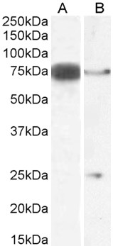 DLL1 Antibody - DLL1 antibody (0.3µg/ml) staining of Mouse Heart (A) and (1ug/ml) Rat Pancreas (B) lysate (35µg protein in RIPA buffer). Detected by chemiluminescence.
