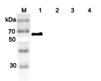 DLL1 Antibody - Western blot analysis of human DLL1 using anti-DLL1 (human), pAb at 1:2,000 dilution. 1. Recombinant human DLL1 (FLAG-tagged). 2. Recombinant human DLL4 (Fc protein) (Negative control). 3. Recombinant human Jagged-1 (Fc protein) (Negative control). 4. Recombinant human IL-33 (FLAG-tagged) (Negative control)
