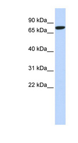 DLL1 Antibody - DLL1 antibody Western blot of HeLa lysate. This image was taken for the unconjugated form of this product. Other forms have not been tested.