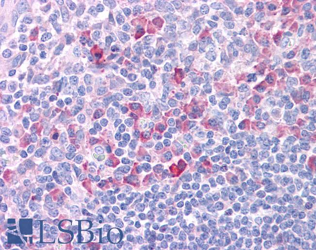 DLL1 Antibody - Anti-DLL1 antibody IHC of human tonsil. Immunohistochemistry of formalin-fixed, paraffin-embedded tissue after heat-induced antigen retrieval. Antibody concentration 5 ug/ml.  This image was taken for the unconjugated form of this product. Other forms have not been tested.