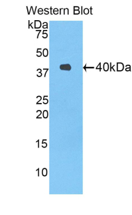 DLL4 Antibody - Western blot of DLL4 antibody.