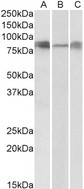 DLL4 Antibody - DLL4 antibody (0.3 ug/ml) staining of Human (A), Mouse(B) and Rat (C) Lung lysates (35 ug protein in RIPA buffer). Primary incubation was 1 hour. Detected by chemiluminescence