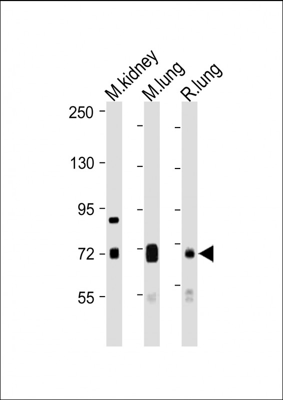DLL4 Antibody - All lanes: Anti-DLL4 Antibody (C-Term) at 1:1000-1:2000 dilution Lane 1: Mouse kidney lysate Lane 2: Mouse lung lysate Lane 3: Rat lung lysate Lysates/proteins at 20 µg per lane. Secondary Goat Anti-Rabbit IgG, (H+L), Peroxidase conjugated at 1/10000 dilution. Predicted band size: 75 kDa Blocking/Dilution buffer: 5% NFDM/TBST.