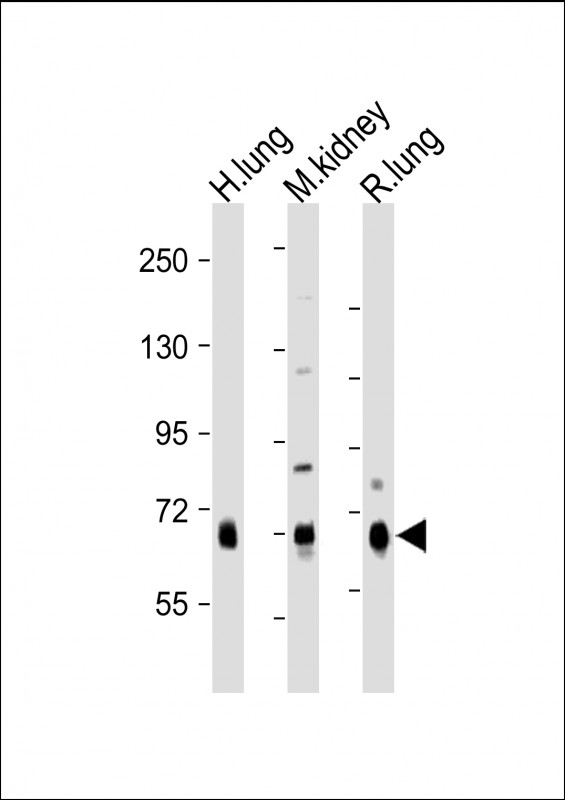 DLL4 Antibody - All lanes: Anti-DLL4 Antibody (C-Term) at 1:1000-1:2000 dilution Lane 1: Human lung lysate Lane 2: Mouse kidney lysate Lane 3: Rat lung lysate Lysates/proteins at 20 µg per lane. Secondary Goat Anti-Rabbit IgG, (H+L), Peroxidase conjugated at 1/10000 dilution. Predicted band size: 75 kDa Blocking/Dilution buffer: 5% NFDM/TBST.