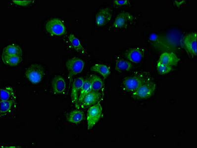 DLL4 Antibody - Immunofluorescent analysis of MCF-7 cells using DLL4 Antibody at dilution of 1:100 and Alexa Fluor 488-congugated AffiniPure Goat Anti-Rabbit IgG(H+L)