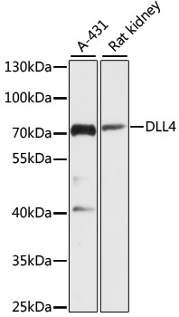DLL4 Antibody - Western blot analysis of extracts of various cell lines, using DLL4 antibody at 1:3000 dilution. The secondary antibody used was an HRP Goat Anti-Rabbit IgG (H+L) at 1:10000 dilution. Lysates were loaded 25ug per lane and 3% nonfat dry milk in TBST was used for blocking. An ECL Kit was used for detection and the exposure time was 90s.