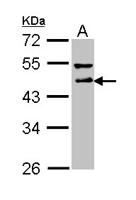 DLST / E2 Antibody - Sample (30 ug of whole cell lysate). A: A431 . 10% SDS PAGE. DLST antibody diluted at 1:1000.
