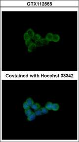 DLST / E2 Antibody - Immunofluorescence of methanol-fixed A431 using DLST antibody at 1:500 dilution.