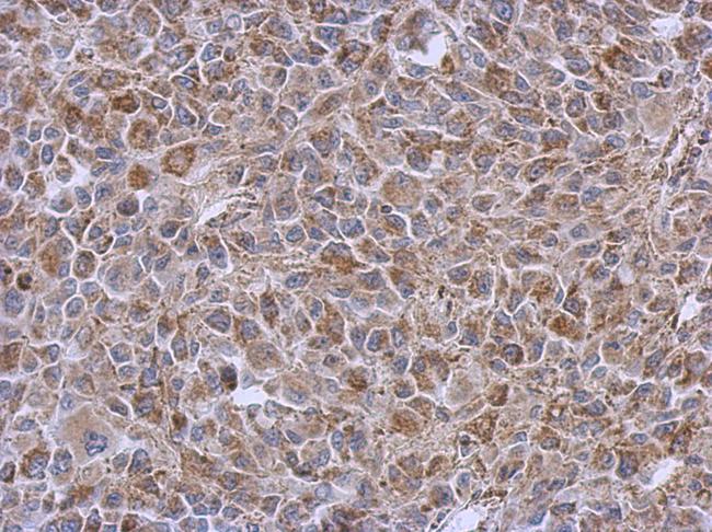 DLST / E2 Antibody - IHC of paraffin-embedded RT2 xenograft using DLST antibody at 1:500 dilution.