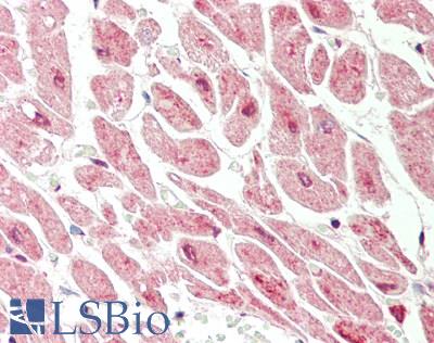 DLST / E2 Antibody - Human Heart: Formalin-Fixed, Paraffin-Embedded (FFPE).  This image was taken for the unconjugated form of this product. Other forms have not been tested.