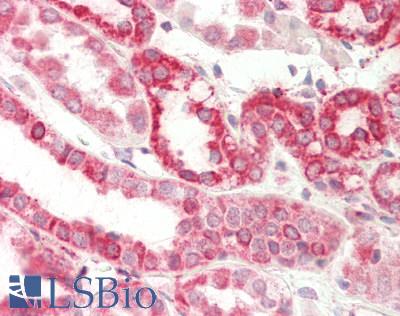 DLST / E2 Antibody - Human Kidney: Formalin-Fixed, Paraffin-Embedded (FFPE).  This image was taken for the unconjugated form of this product. Other forms have not been tested.