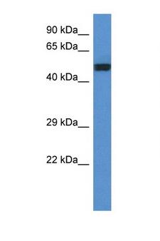 DLST / E2 Antibody - DLST antibody western blot of Placenta lysate. Antibody concentration 1 ug/ml.  This image was taken for the unconjugated form of this product. Other forms have not been tested.