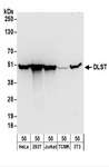 DLST / E2 Antibody - Detection of Human and Mouse DLST by Western Blot. Samples: Whole cell lysate (50 ug) from HeLa, 293T, Jurkat, mouse TCMK-1, and mouse NIH3T3 cells. Antibodies: Affinity purified rabbit anti-DLST antibody used for WB at 0.1 ug/ml. Detection: Chemiluminescence with an exposure time of 30 seconds.