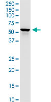 DLST / E2 Antibody - DLST monoclonal antibody (M01), clone 4D7. Western Blot analysis of DLST expression in PC-12.