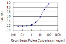DLST / E2 Antibody - Detection limit for recombinant GST tagged DLST is 0.3 ng/ml as a capture antibody.
