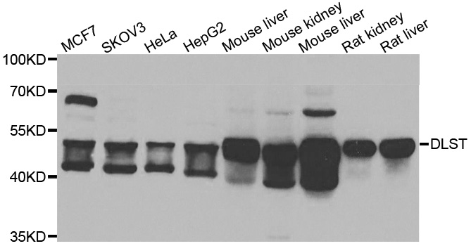 DLST / E2 Antibody - Western blot analysis of extracts of various cell lines.