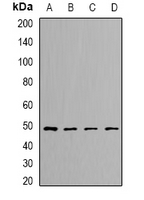 DLST / E2 Antibody - Western blot analysis of DLST expression in SKOV3 (A); HeLa (B); mouse kidney (C); rat liver (D) whole cell lysates.