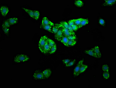 DLST / E2 Antibody - Immunofluorescence staining of HepG2 cells at a dilution of 1:100, counter-stained with DAPI. The cells were fixed in 4% formaldehyde, permeabilized using 0.2% Triton X-100 and blocked in 10% normal Goat Serum. The cells were then incubated with the antibody overnight at 4°C.The secondary antibody was Alexa Fluor 488-congugated AffiniPure Goat Anti-Rabbit IgG (H+L) .