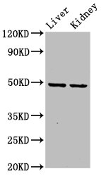 DLST / E2 Antibody - Positive Western Blot detected in Rat liver tissue, Rat kidney tissue. All lanes: DLST antibody at 5.9 µg/ml Secondary Goat polyclonal to rabbit IgG at 1/50000 dilution. Predicted band size: 49, 40 KDa. Observed band size: 49 KDa