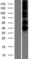 DLST / E2 Protein - Western validation with an anti-DDK antibody * L: Control HEK293 lysate R: Over-expression lysate