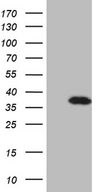 DLX1 Antibody - HEK293T cells were transfected with the pCMV6-ENTRY control. (Left lane) or pCMV6-ENTRY DLX1. (Right lane) cDNA for 48 hrs and lysed. Equivalent amounts of cell lysates. (5 ug per lane) were separated by SDS-PAGE and immunoblotted with anti-DLX1. (1:2000)