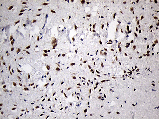 DLX1 Antibody - Immunohistochemical staining of paraffin-embedded Human adult brain tissue within the normal limits using anti-DLX1 mouse monoclonal antibody. (Heat-induced epitope retrieval by 1mM EDTA in 10mM Tris buffer. (pH8.5) at 120 oC for 3 min. (1:500)