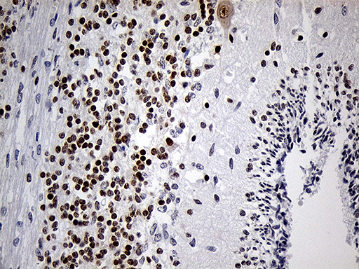 DLX1 Antibody - Immunohistochemical staining of paraffin-embedded Human embryonic cerebellum within the normal limits using anti-DLX1 mouse monoclonal antibody. (Heat-induced epitope retrieval by 1mM EDTA in 10mM Tris buffer. (pH8.5) at 120 oC for 3 min. (1:500)