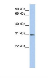 DLX1 Antibody - Placenta lysate. Antibody concentration: 1.0 ug/ml. Gel concentration: 12%.  This image was taken for the unconjugated form of this product. Other forms have not been tested.