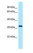 DLX1 Antibody - DLX1 antibody Western Blot of Rat Pancreas.  This image was taken for the unconjugated form of this product. Other forms have not been tested.