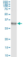 DLX1 Antibody - Immunoprecipitation of DLX1 transfected lysate using anti-DLX1 monoclonal antibody and Protein A Magnetic Bead, and immunoblotted with DLX1 rabbit polyclonal antibody.