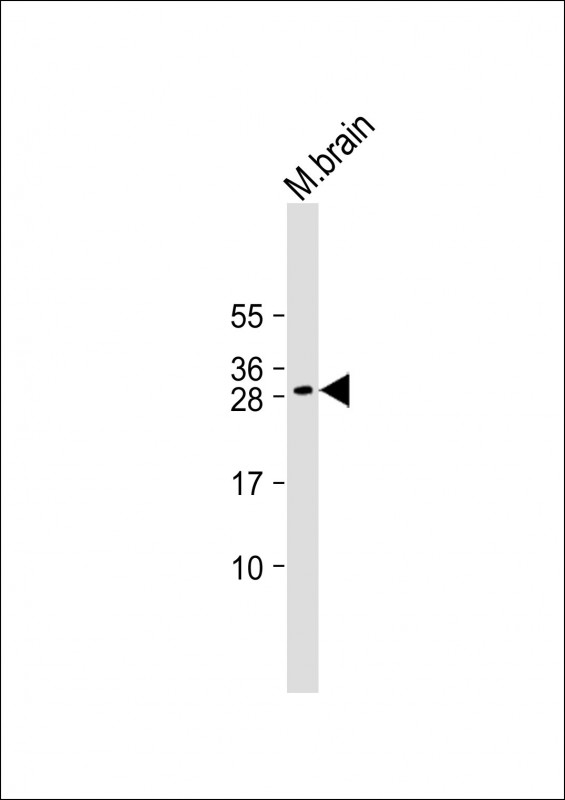 DLX1 Antibody - Anti-DLX1 Antibody (Center) at 1:2000 dilution + Mouse brain lysate Lysates/proteins at 20 µg per lane. Secondary Goat Anti-Rabbit IgG, (H+L), Peroxidase conjugated at 1/10000 dilution. Predicted band size: 27 kDa Blocking/Dilution buffer: 5% NFDM/TBST.