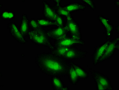 DLX1 Antibody - Immunofluorescence staining of Hela cells at a dilution of 1:66, counter-stained with DAPI. The cells were fixed in 4% formaldehyde, permeabilized using 0.2% Triton X-100 and blocked in 10% normal Goat Serum. The cells were then incubated with the antibody overnight at 4 °C.The secondary antibody was Alexa Fluor 488-congugated AffiniPure Goat Anti-Rabbit IgG (H+L) .