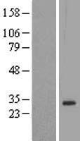 DLX1 Protein - Western validation with an anti-DDK antibody * L: Control HEK293 lysate R: Over-expression lysate