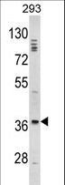 DLX2 Antibody - Western blot of DLX2 Antibody in 293 cell line lysates (35 ug/lane). DLX2 (arrow) was detected using the purified antibody.