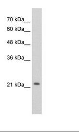 DLX2 Antibody - HepG2 Cell Lysate.  This image was taken for the unconjugated form of this product. Other forms have not been tested.