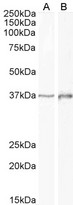 DLX2 Antibody - Goat anti-DLX2 (aa279-292) Antibody (1µg/ml) staining of Human Cerebellum (A) and Rat (B) Brain lysate (35µg protein in RIPA buffer). Primary incubation was 1 hour. Detected by chemiluminescencence.