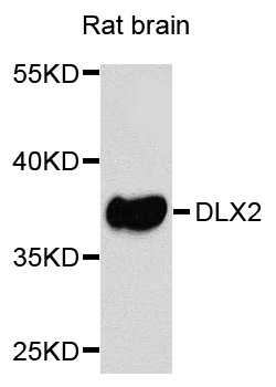 DLX2 Antibody - Western blot analysis of extracts of rat brain cells.