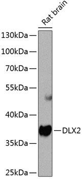 DLX2 Antibody - Western blot analysis of extracts of rat brain using DLX2 Polyclonal Antibody at dilution of 1:1000.